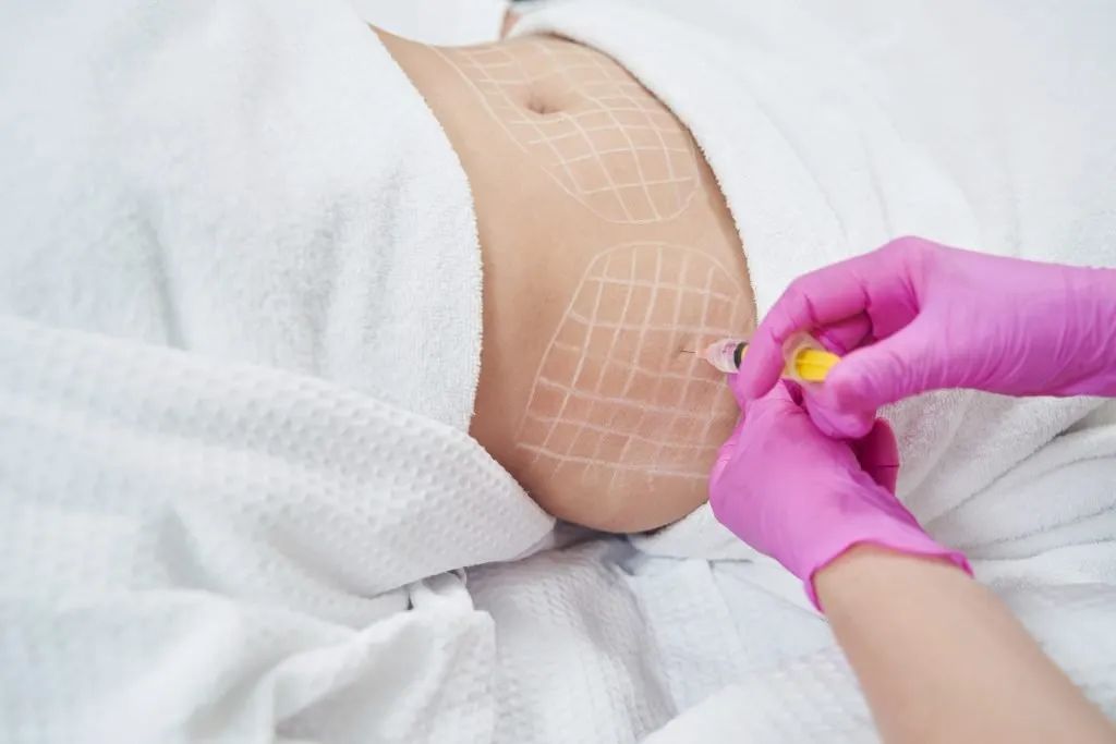 Fat Dissolving Injections at Ava Aesthetics & Laser